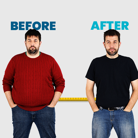 Bariatric Surgery