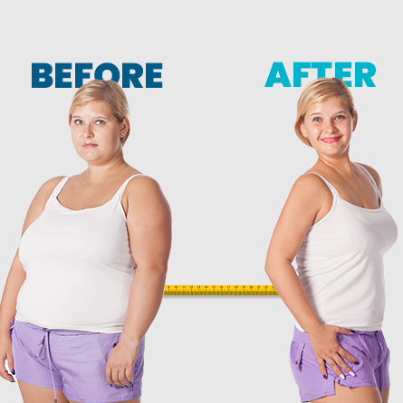 Metabolic Surgery